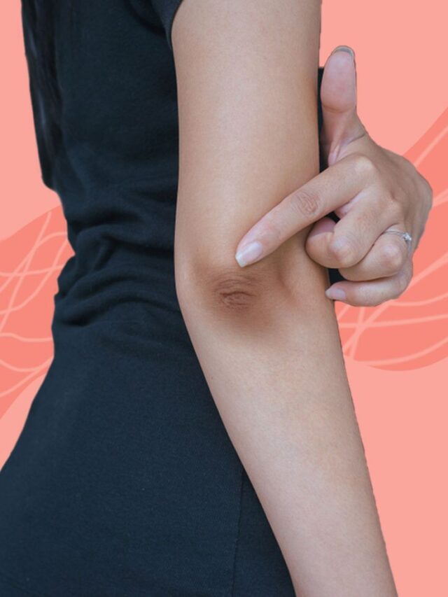 Easily Remove Dark Spots with Lemon Juice
